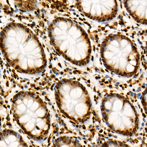 Acetyl-Histone H4-K12 Rabbit mAb