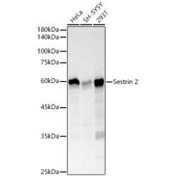 Sestrin 2 Rabbit mAb