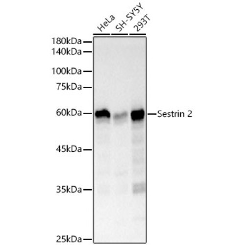 Sestrin 2 Rabbit mAb