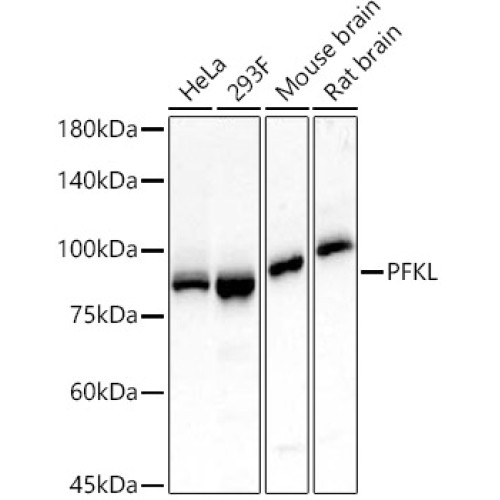 PFKL Rabbit mAb