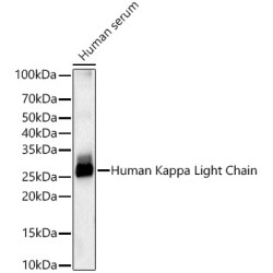 Human Kappa Light Chain Rabbit mAb