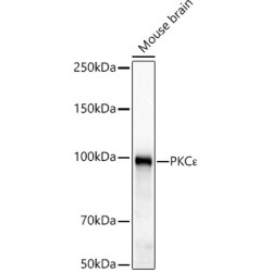 PKCε Rabbit mAb