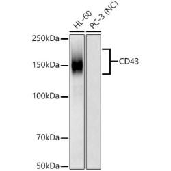 CD43 Rabbit mAb