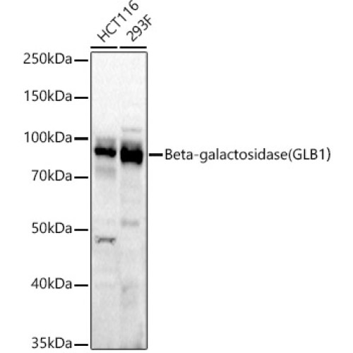 Beta-galactosidase （GLB1）Rabbit mAb