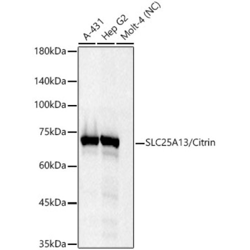 SLC25A13/Citrin Rabbit mAb