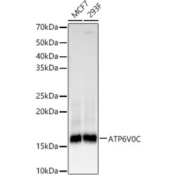 ATP6V0C Rabbit mAb