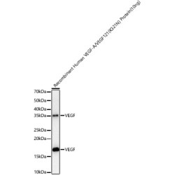 VEGF Rabbit mAb