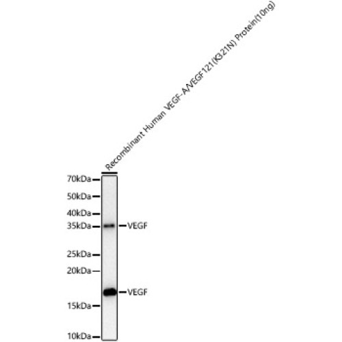 VEGF Rabbit mAb