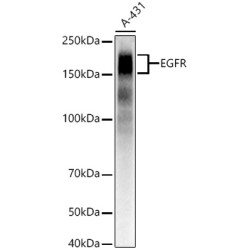 EGFR Rabbit mAb