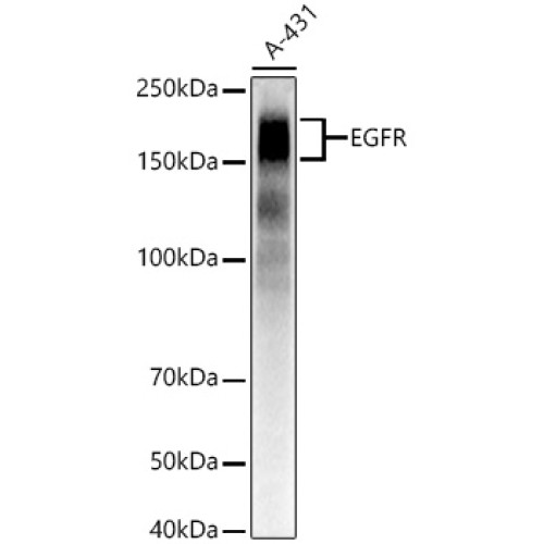 EGFR Rabbit mAb