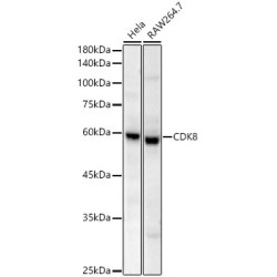 CDK8 Rabbit mAb