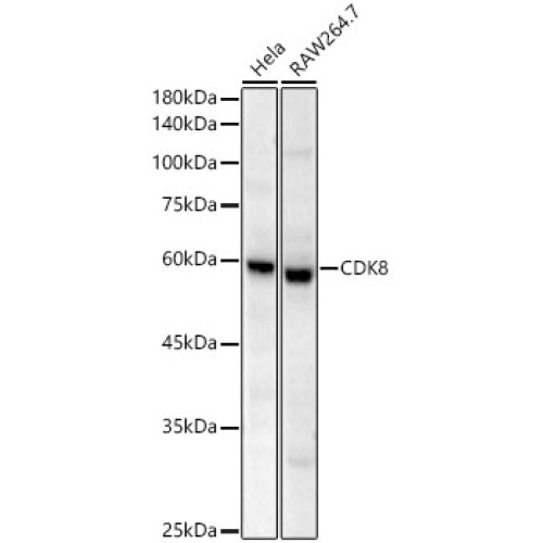 CDK8 Rabbit mAb