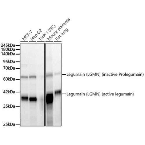 Legumain (LGMN) Rabbit mAb