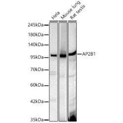 AP2B1 Rabbit mAb