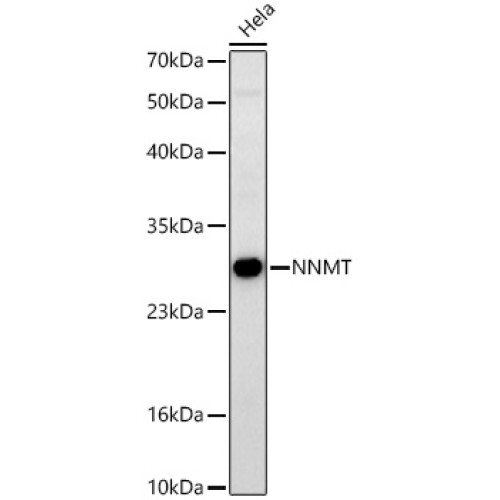 NNMT Rabbit mAb