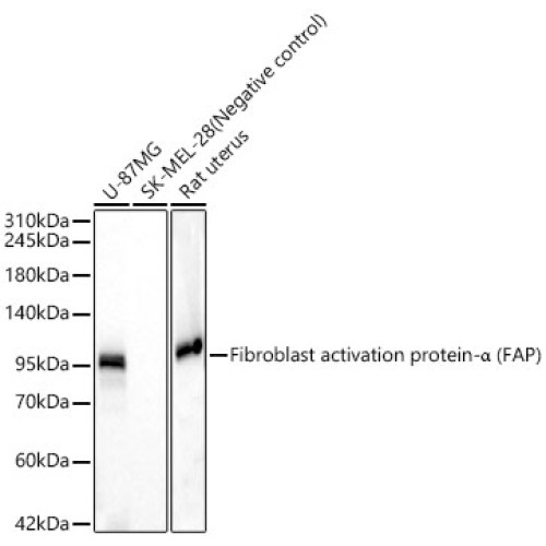 Fibroblast activation protein-α (FAP) Rabbit mAb