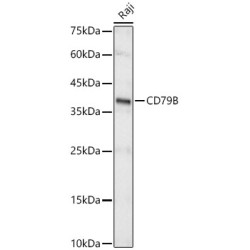 CD79B Rabbit mAb