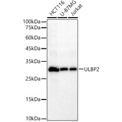 ULBP2 Rabbit mAb