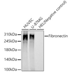 Fibronectin Rabbit mAb