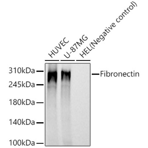 Fibronectin Rabbit mAb