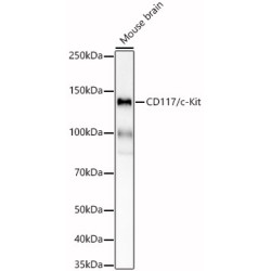CD117/c-Kit Rabbit mAb