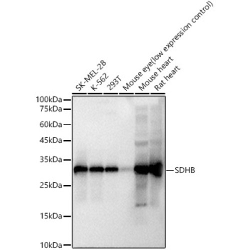 SDHB Rabbit mAb