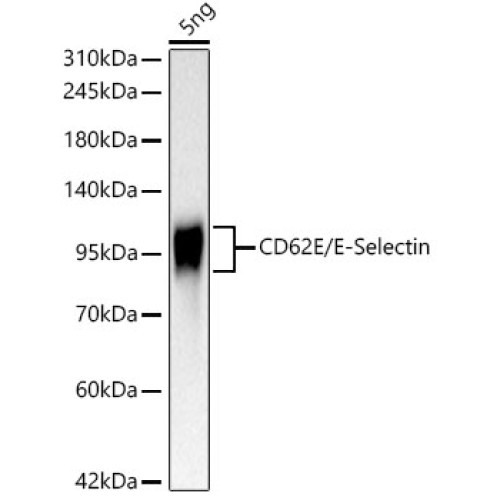 CD62E/E-Selectin Rabbit mAb