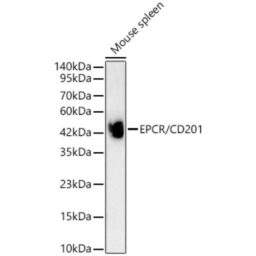 EPCR/CD201 Rabbit mAb