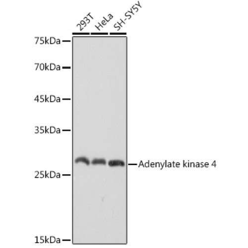 Adenylate kinase 4 Rabbit mAb