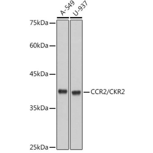 CCR2/CKR2 Rabbit mAb