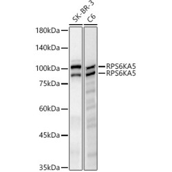 RPS6KA5 Rabbit mAb