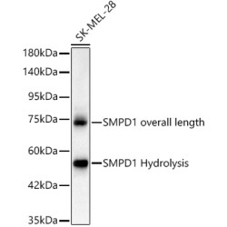 [KO Validated] SMPD1 Rabbit mAb