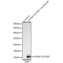 S100A12/CGRP Rabbit mAb