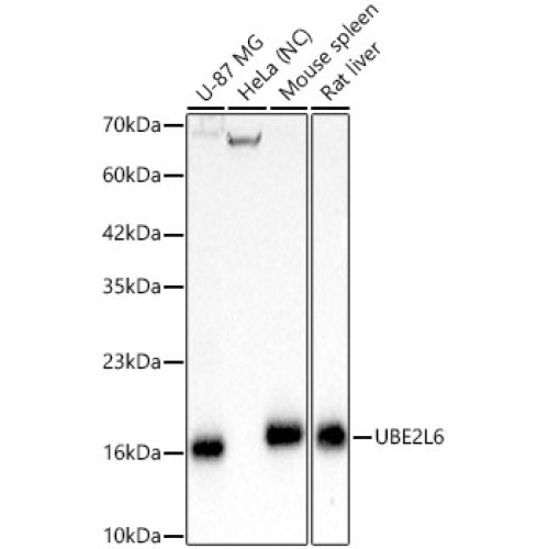 UBE2L6 Rabbit mAb