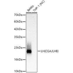LH(CGA/LHB) Rabbit mAb