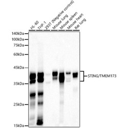 STING/TMEM173 Rabbit mAb