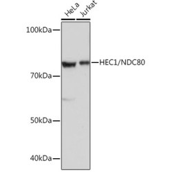 HEC1/NDC80 Rabbit mAb