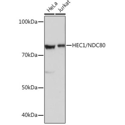 HEC1/NDC80 Rabbit mAb