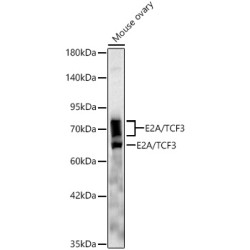 E2A/TCF3 Rabbit mAb