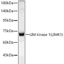 LIM kinase 1(LIMK1) Rabbit mAb