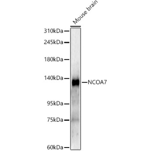 NCOA7 Rabbit mAb