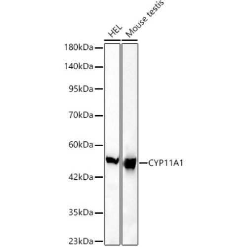 CYP11A1 Rabbit mAb