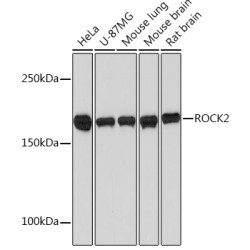 ROCK2 Rabbit mAb