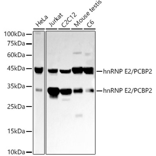 hnRNP E2/PCBP2 Rabbit mAb