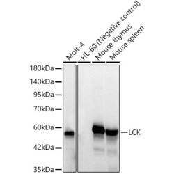 LCK Rabbit mAb