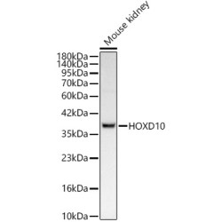 HOXD10 Rabbit mAb