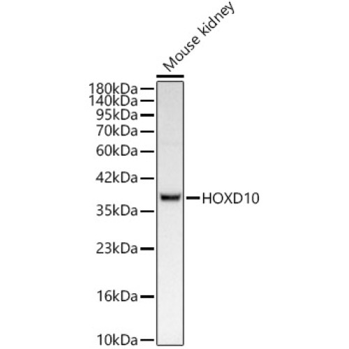 HOXD10 Rabbit mAb