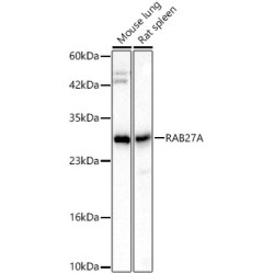 [KD Validated] RAB27A Rabbit mAb