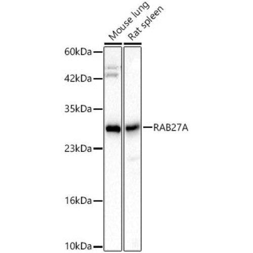 [KD Validated] RAB27A Rabbit mAb