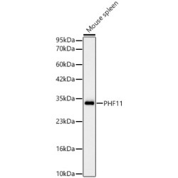 [KD Validated] PHF11 Rabbit mAb